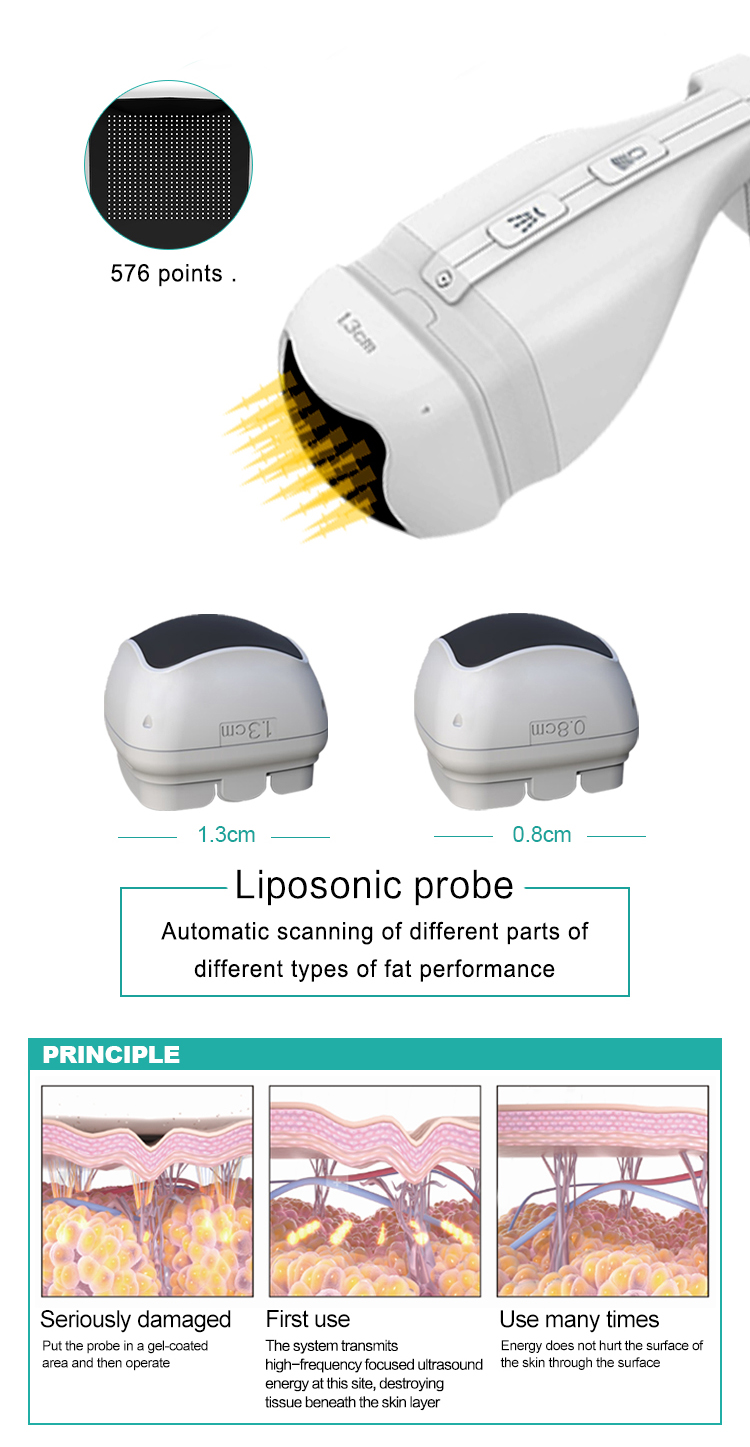 HIFU+Liposonix